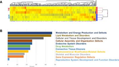 Smoothelin-Like Protein 1 Regulates Development and Metabolic Transformation of Skeletal Muscle in Hyperthyroidism